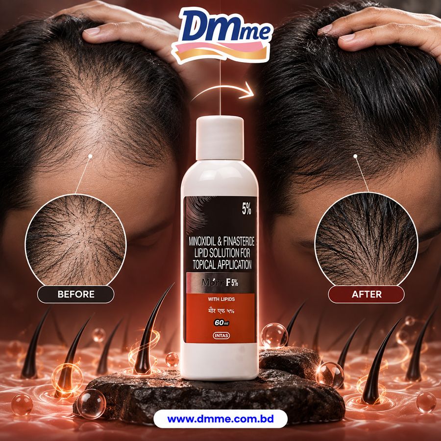 Morr F 5% Minoxidil & Finastride Lipid Solution For Topical Application 60ml